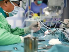 Szeged, okos cochleáris implantátum beültetés, műtét, Szegedi Tudományegyetem, SZTE, Fül- Orr- Gégészeti és Fej- Nyaksebészeti Klinik, hallókészülék, műtő, klinika, egészségügy