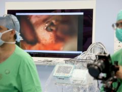 Szeged, okos cochleáris implantátum beültetés, műtét, Szegedi Tudományegyetem, SZTE, Fül- Orr- Gégészeti és Fej- Nyaksebészeti Klinik, hallókészülék, műtő, klinika, egészségügy