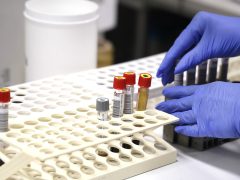 Szeged, Európai Laboratóriumi Dolgozók Napja, nyílt nap, Szegedi Tudományegyetem, SZTE, Szent-Györgyi Albert Klinikai Központ, Laboratóriumi Medicina, labor, vérvétel, vér, vizsgálat, egészségügy