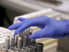 Szeged, Európai Laboratóriumi Dolgozók Napja, nyílt nap, Szegedi Tudományegyetem, SZTE, Szent-Györgyi Albert Klinikai Központ, Laboratóriumi Medicina, labor, vérvétel, vér, vizsgálat, egészségügy