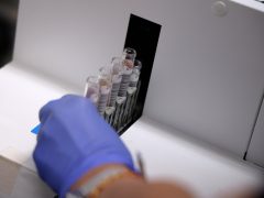 Szeged, Európai Laboratóriumi Dolgozók Napja, nyílt nap, Szegedi Tudományegyetem, SZTE, Szent-Györgyi Albert Klinikai Központ, Laboratóriumi Medicina, labor, vérvétel, vér, vizsgálat, egészségügy