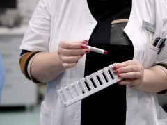 Szeged, Európai Laboratóriumi Dolgozók Napja, nyílt nap, Szegedi Tudományegyetem, SZTE, Szent-Györgyi Albert Klinikai Központ, Laboratóriumi Medicina, labor, vérvétel, vér, vizsgálat, egészségügy