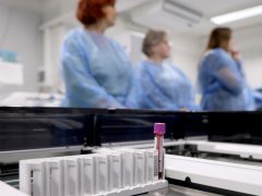 Szeged, Európai Laboratóriumi Dolgozók Napja, nyílt nap, Szegedi Tudományegyetem, SZTE, Szent-Györgyi Albert Klinikai Központ, Laboratóriumi Medicina, labor, vérvétel, vér, vizsgálat, egészségügy