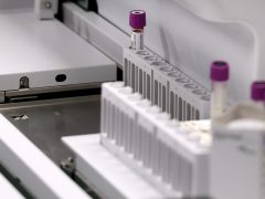 Szeged, Európai Laboratóriumi Dolgozók Napja, nyílt nap, Szegedi Tudományegyetem, SZTE, Szent-Györgyi Albert Klinikai Központ, Laboratóriumi Medicina, labor, vérvétel, vér, vizsgálat, egészségügy