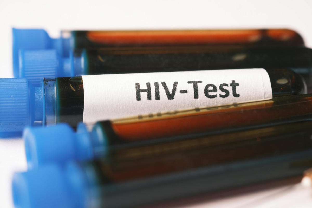 HIV vírus. oltás. Teszt.